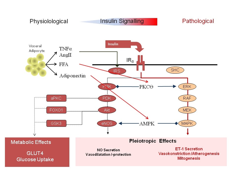 Pathways of Diabetes: Beta cell dysfunction and insulin signalling