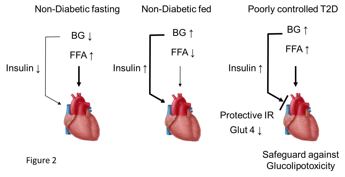 Understanding Insulin Resistance (Part 1)