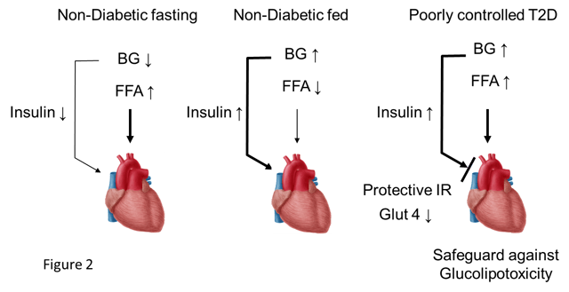 insulin_resistance_in_the_heart.png