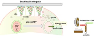 Smart Insulin Patches or Glucose-Responsive Insulin Delivery Systems