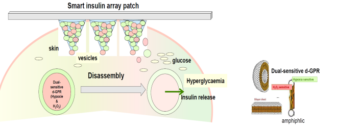 Smart Insulin Patches or Glucose-Responsive Insulin Delivery Systems