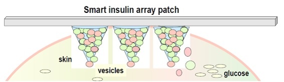 smart_insulin_patch.jpg