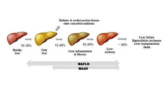 Non-invasive liver fat and liver stiffness screening at Profil
